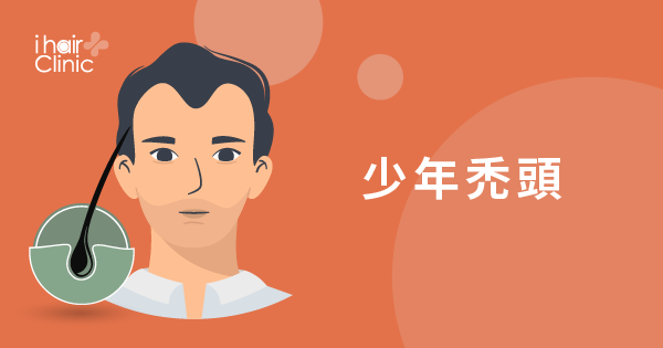 少年禿頭影片-高雄植髮推薦｜ihair風華御髮