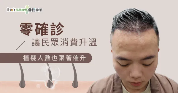 男性雄性禿植髮-高雄植髮推薦