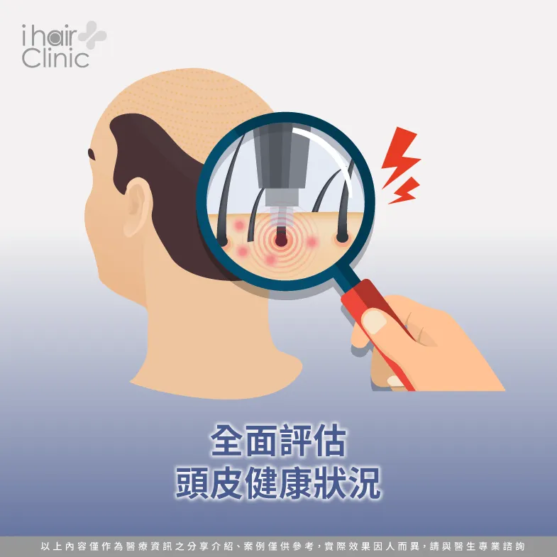 評估頭皮健康狀況-植髮失敗怎麼辦