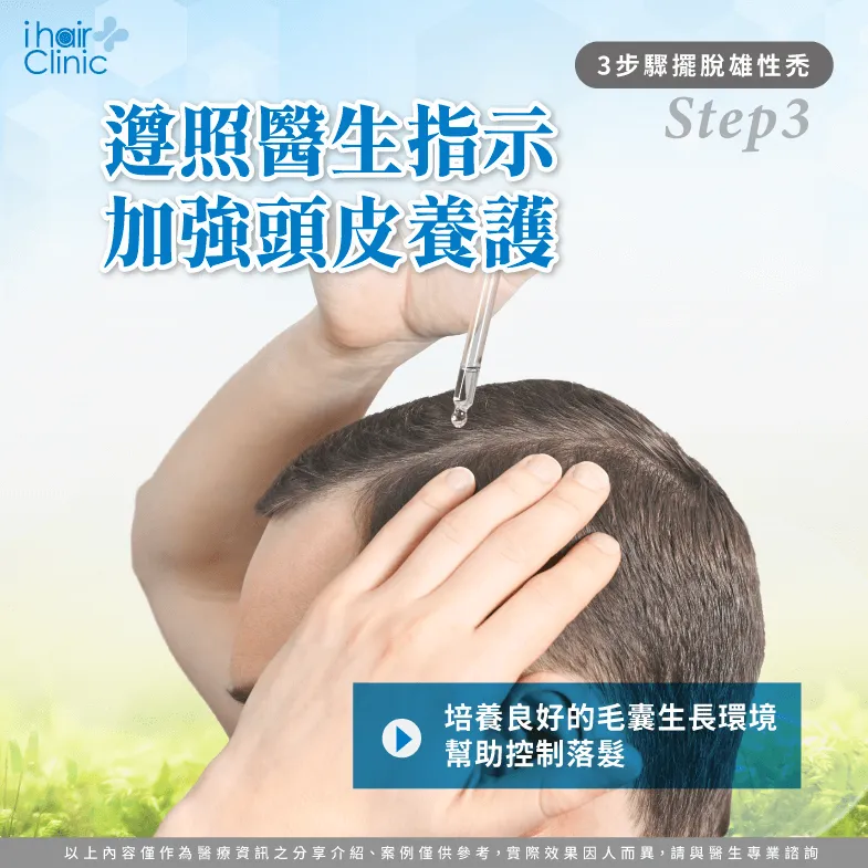 細心照護頭皮健康-為什麼會雄性禿