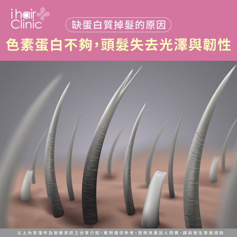 色素蛋白影響頭髮顏色與光澤-缺蛋白質 掉髮