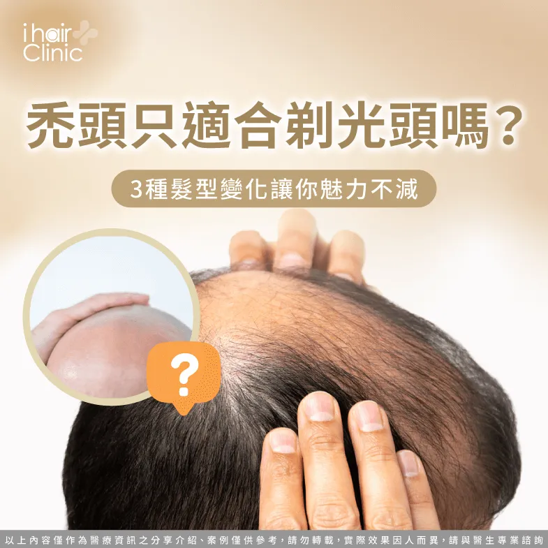 禿頭只適合剃光頭嗎?3種合適髮型變化一次帶你看 禿頭適合的3種髮型變化一次看-禿頭 剃光頭