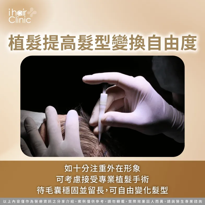 可考慮接受植髮手術,待毛囊穩固並生長後,便可提高髮型變換自由度! 透過植髮提高髮型變換自由度-禿頭 剃光頭