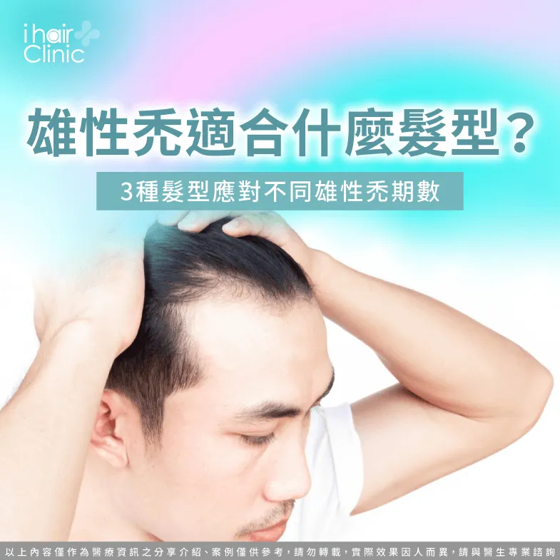 雄性禿適合髮型3大建議一次看-雄性禿適合什麼髮型