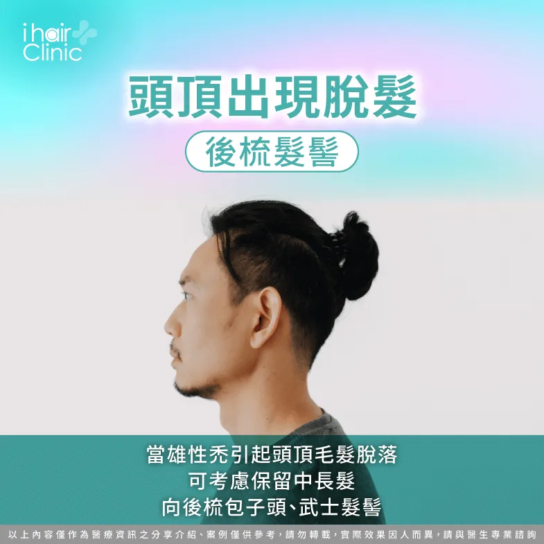 可保留長髮梳丸子頭或武士髮髻-雄性禿適合什麼髮型