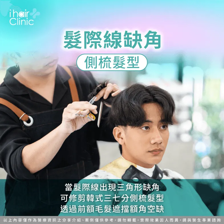 修剪紋理層次短髮遮擋倒退額角-雄性禿適合髮型