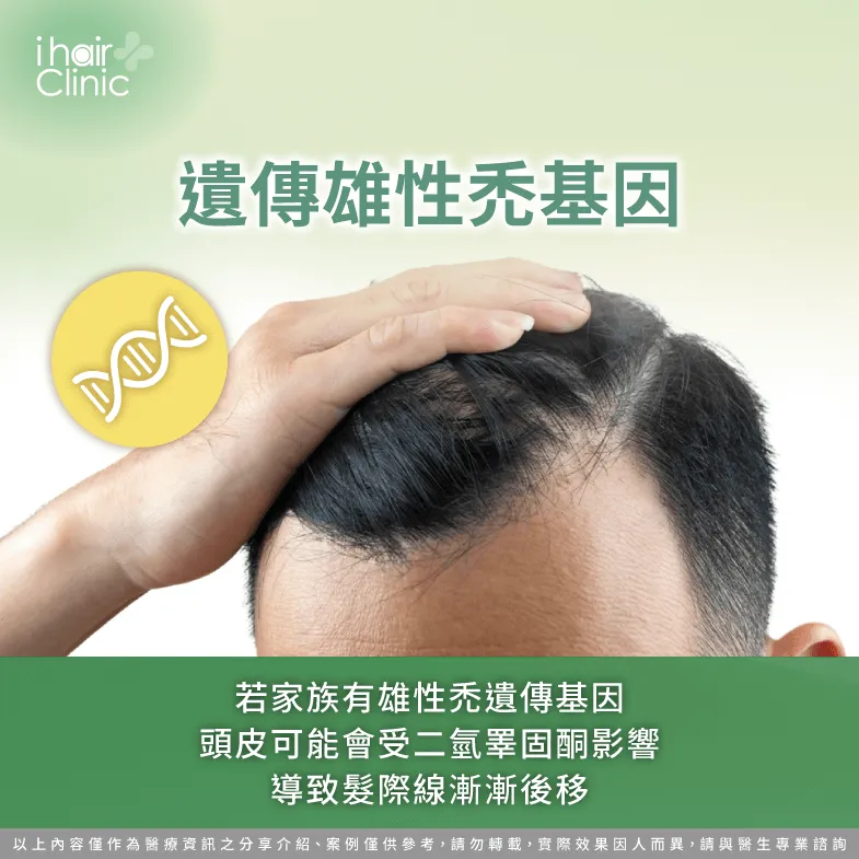 雄性禿初期症狀會出現髮際線後移現象,可藉此判斷是否有遺傳雄性禿基因,並及早進行治療 遺傳雄性禿基因導致髮際線後移-前額頭髮稀疏