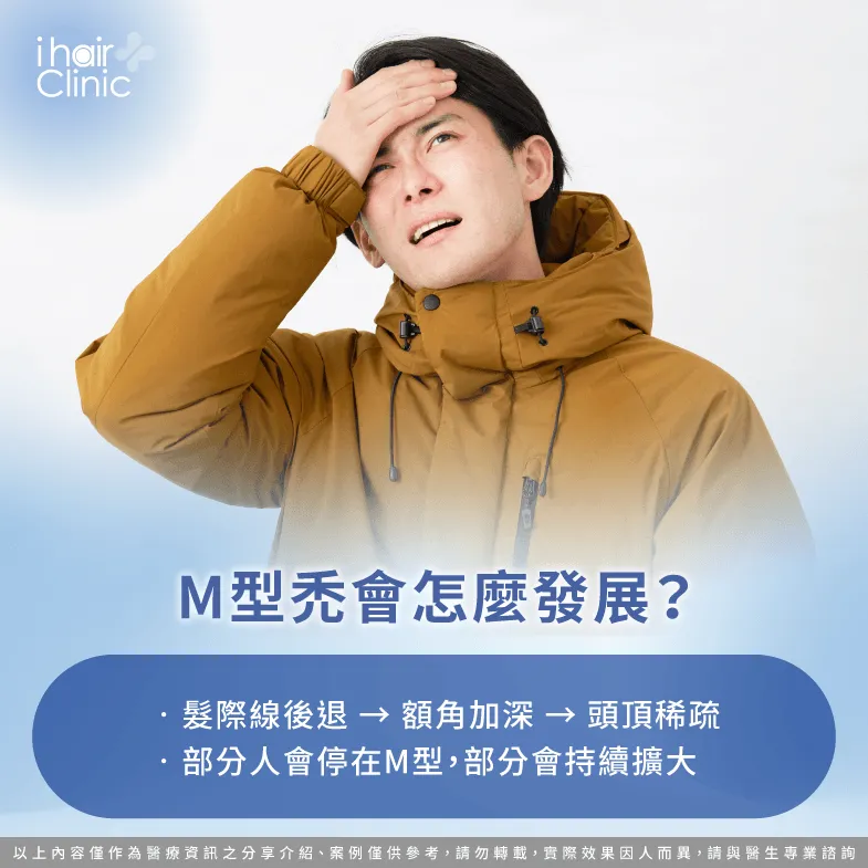 掉髮進程-M型禿會 變嚴重