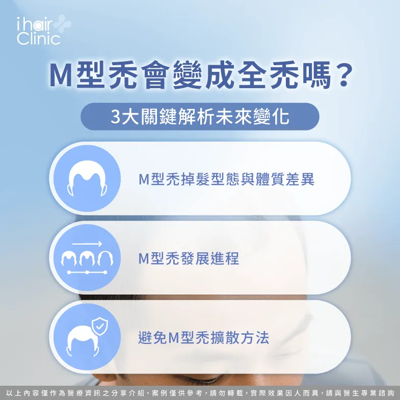 M型禿會 變嚴重-M型禿會 全禿