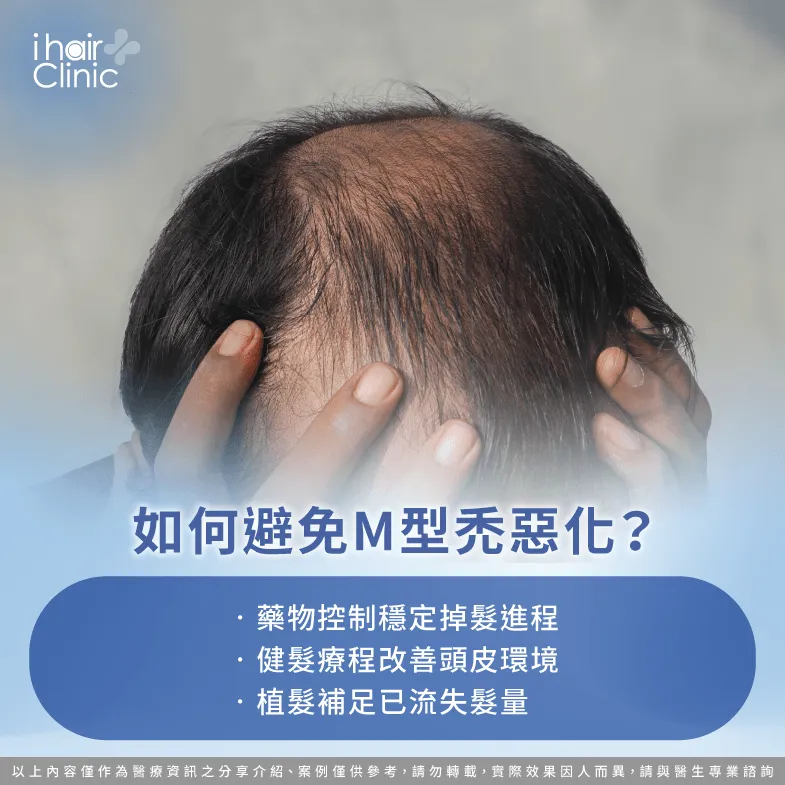 避免M型禿惡化-M型禿會 全禿