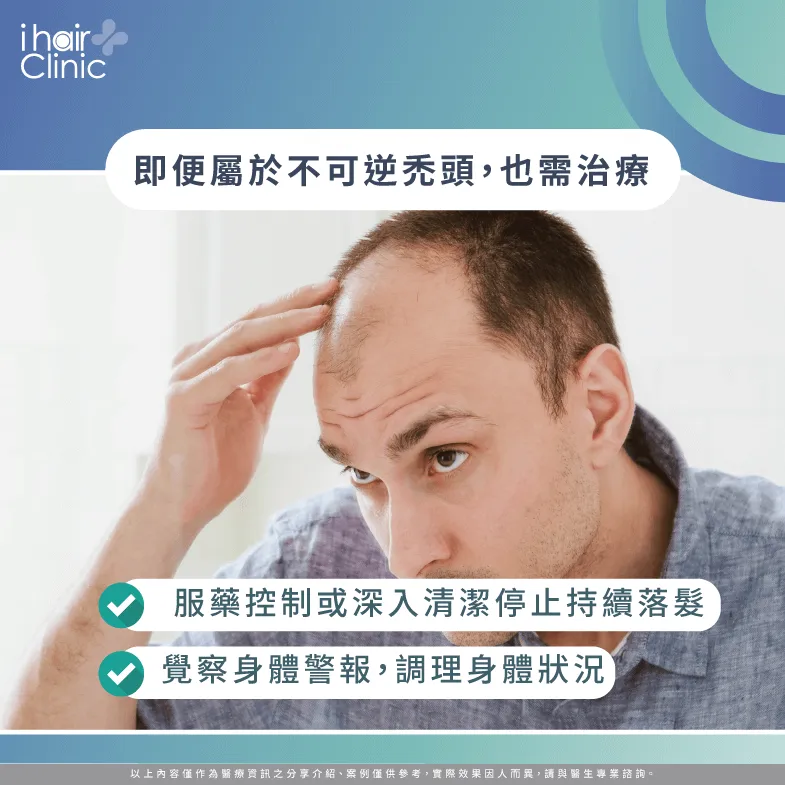 不可逆禿頭也要治療-禿頭可逆嗎