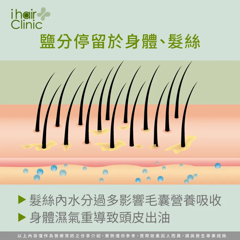 鹽分水分滯留導致掉髮-吃太鹹會禿頭嗎