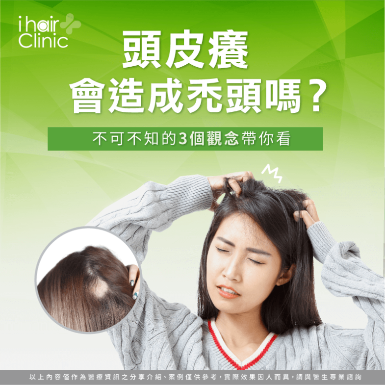頭皮癢會禿頭嗎-植髮頭皮癢