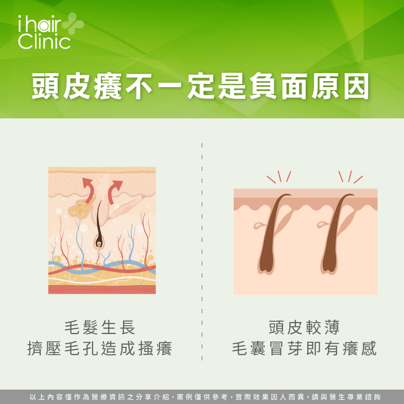 頭皮癢毛髮生長-頭皮癢會禿頭嗎