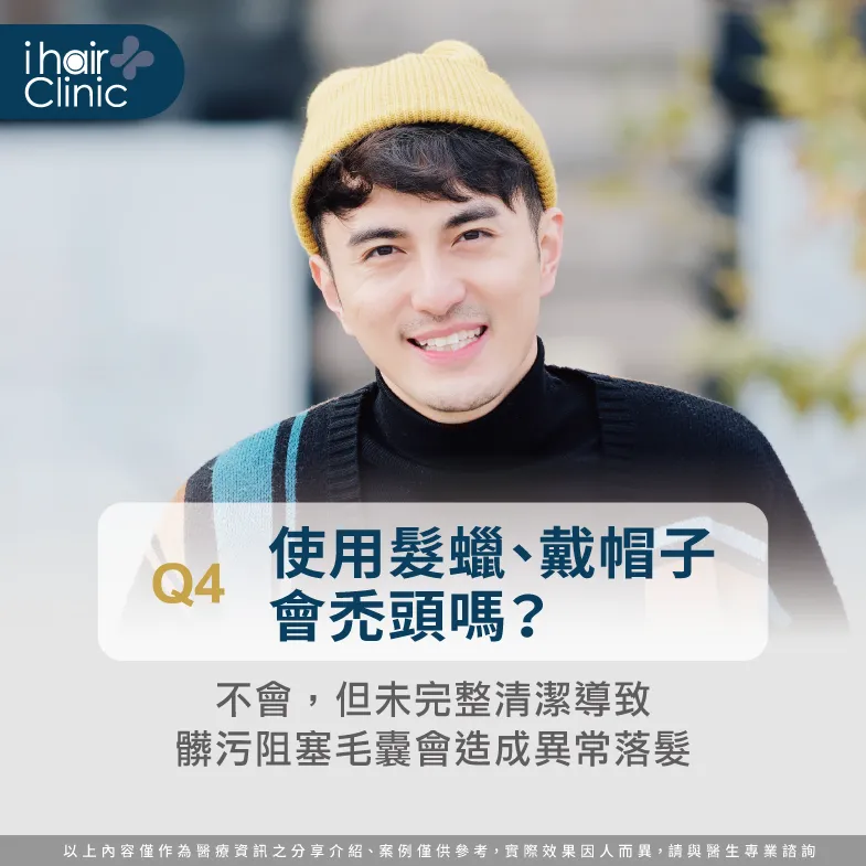 用髮蠟戴帽子禿頭-男性禿頭原因