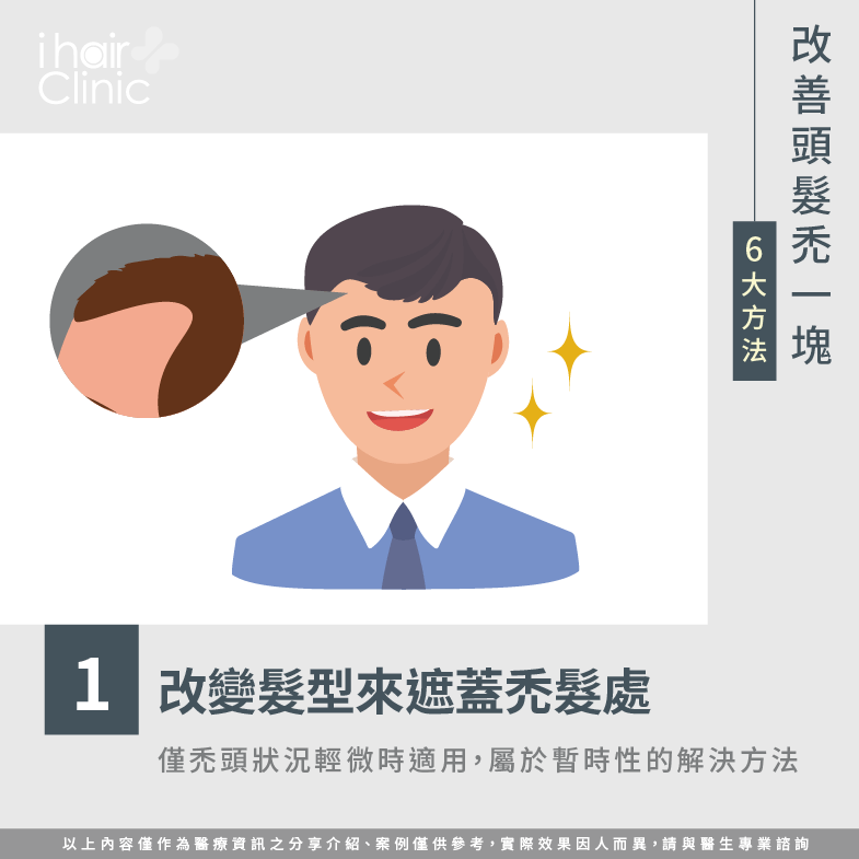 運用髮型修飾-頭髮 禿一塊