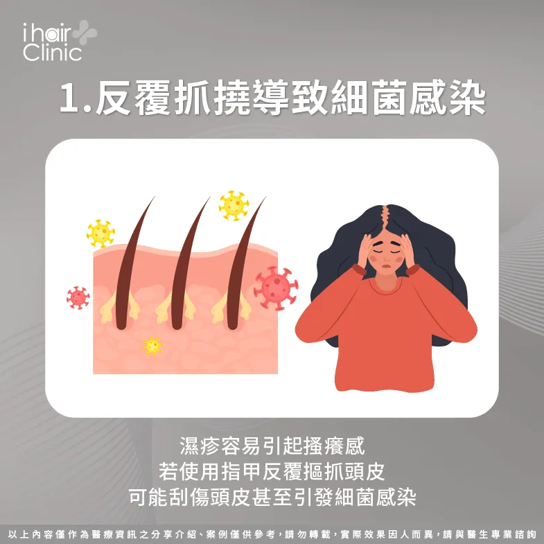 避免使用指甲摳抓頭皮以免細菌感染-頭皮 濕疹 脫髮
