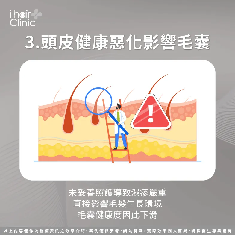應及早就醫治療改善頭皮濕疹-頭皮 濕疹 脫髮