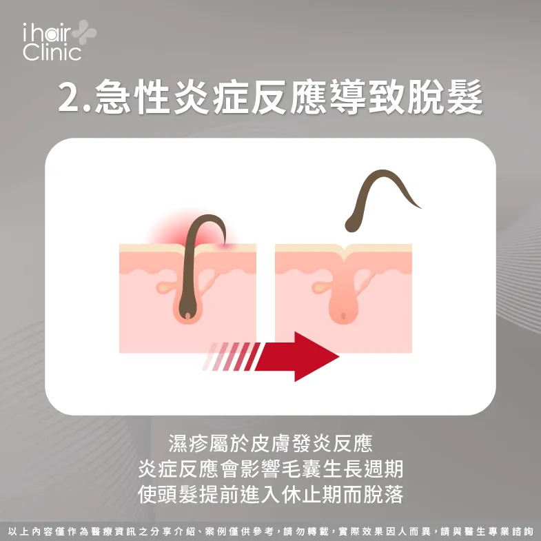 發炎導致毛髮提早進入休止期-頭皮 濕疹 怎麼辦