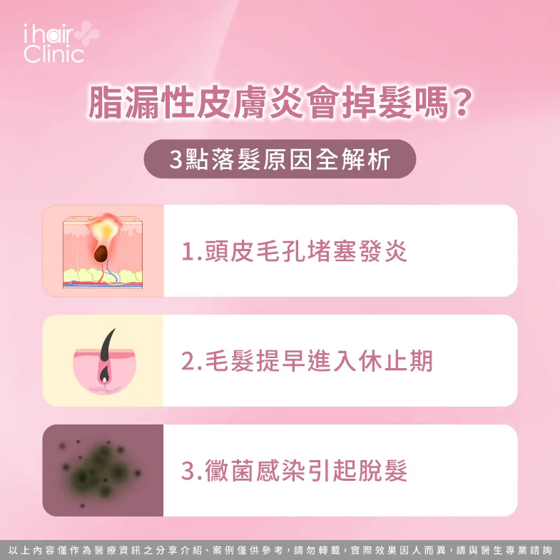 脂漏性皮膚炎掉髮3點原因一次公開-脂漏性皮膚炎 掉髮