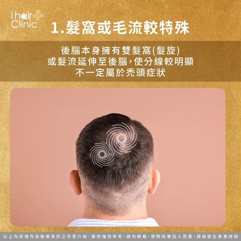 雙髮窩或特殊髮流影響頭髮分線-後腦杓髮線明顯
