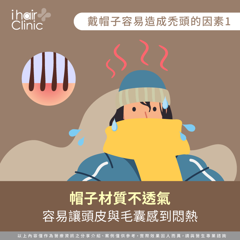 帽子材質-戴帽子會禿頭嗎