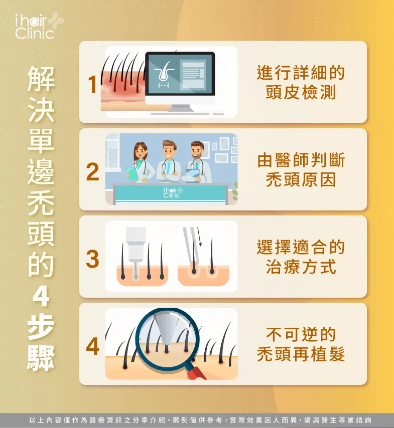 改善單邊禿頭4步驟-單邊禿頭