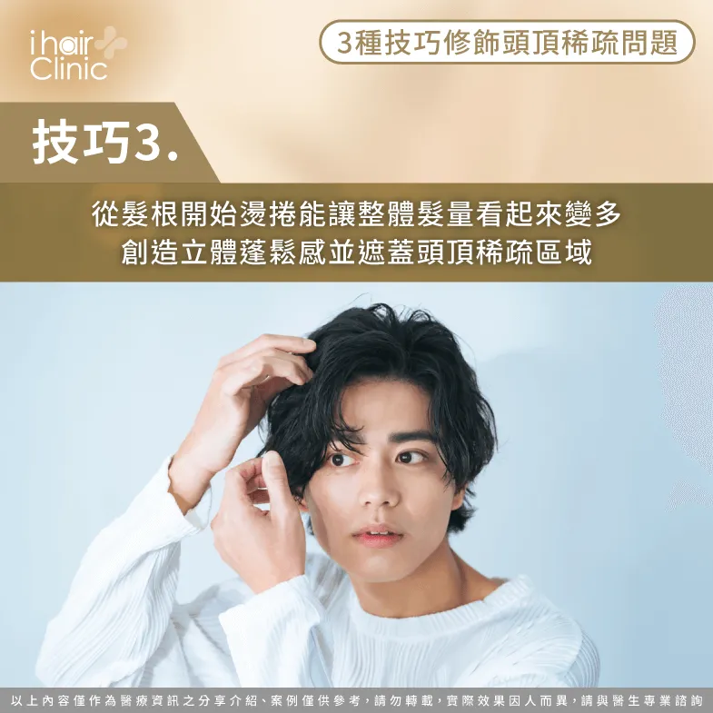 燙捲增加蓬鬆視覺效果-頭頂稀疏髮型