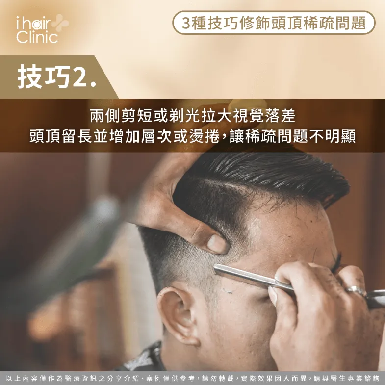兩側漸層剃短搭配頭頂留長-頭頂稀疏髮型