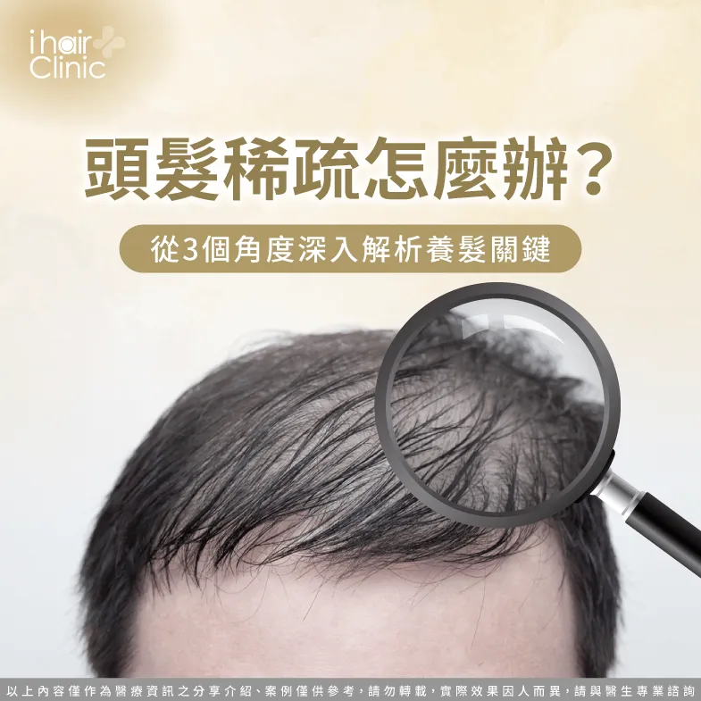 頭髮稀疏怎麼辦?3大改善建議一次帶你了解 頭髮稀疏改善3大關鍵一次看-頭髮稀疏怎麼辦