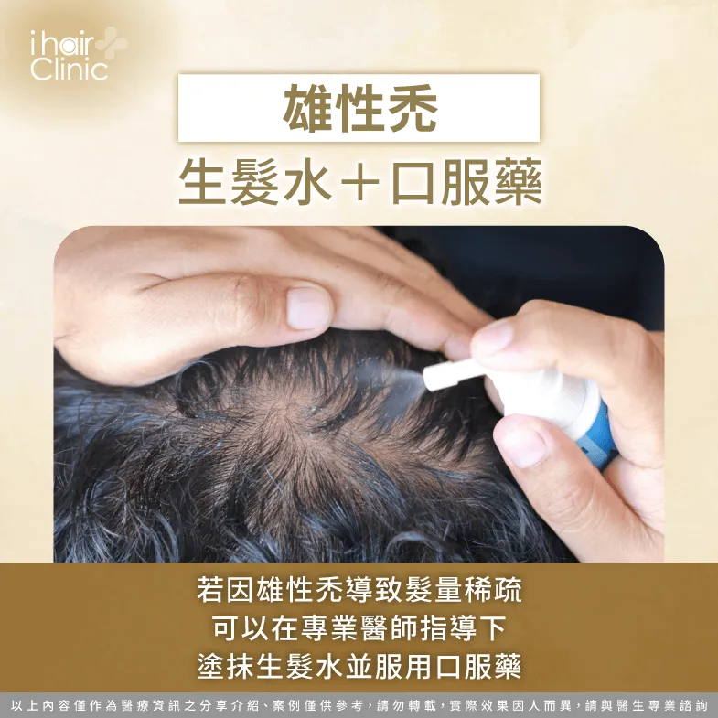 若本身有雄性禿症狀,可以在醫師建議與指導下,使用生髮水或口服藥藉此減緩落髮現象 可外用生髮水或服用口服藥減緩落髮-頭髮稀疏怎麼辦