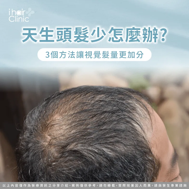 天生頭髮少的3個養護髮建議一次了解-天生頭髮少怎麼辦