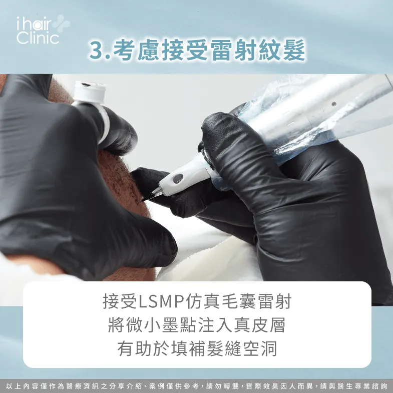 透過雷射紋髮營造茂密視覺髮量-天生頭髮少怎麼辦