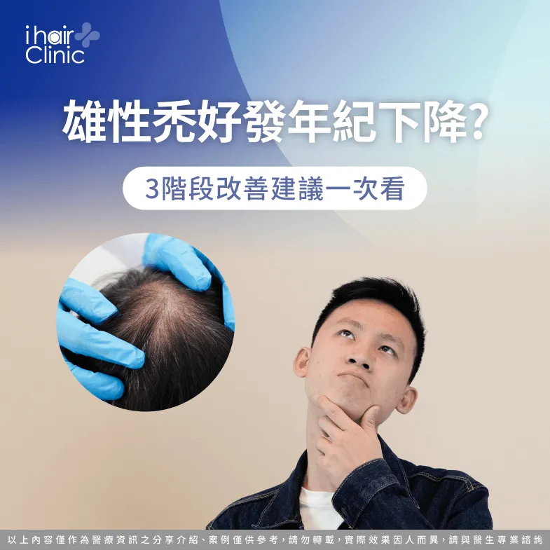 3大雄性禿年齡層與改善建議一次看-雄性禿好發年紀下降