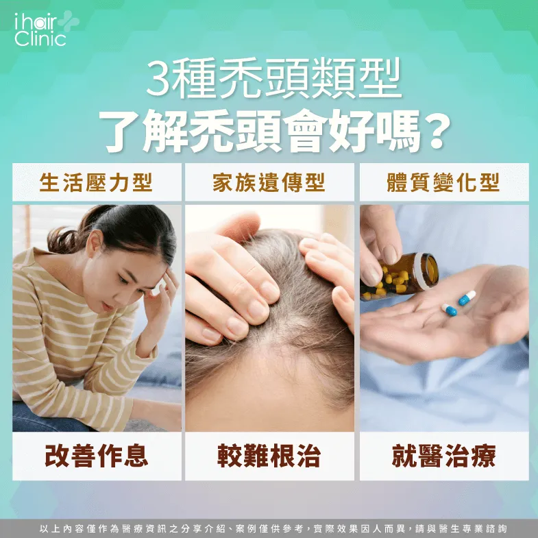 3種常見禿頭類型-禿頭會好嗎