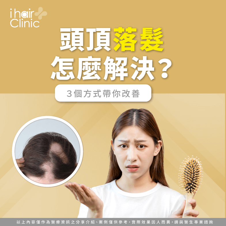 頭頂落髮怎麼解決 3個方式帶你改善 Ihair風華御髮