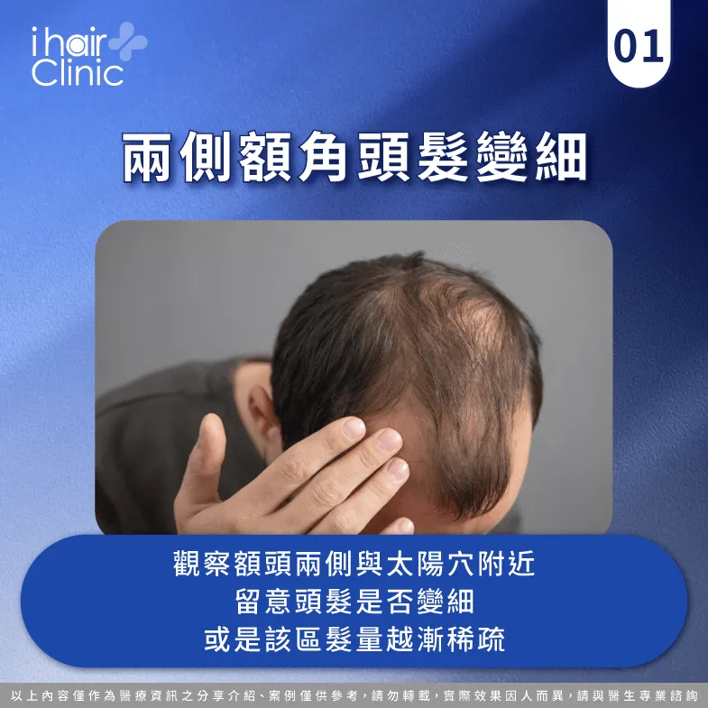 兩側額角頭髮是否變稀疏且易脫落-M型禿 長回來