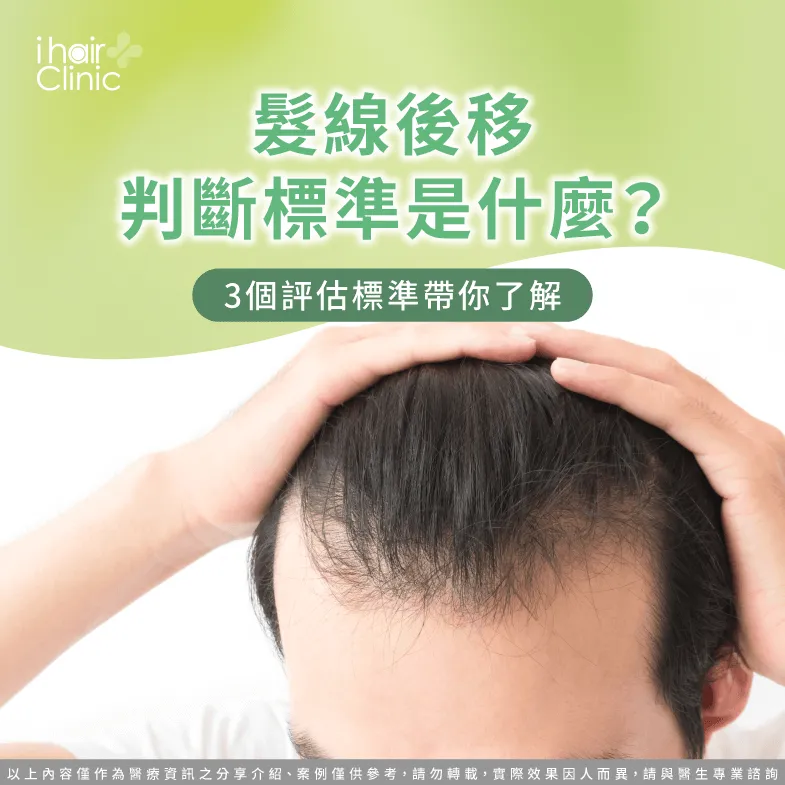 髮線後移3個判斷方法一次分享-髮線後移判斷