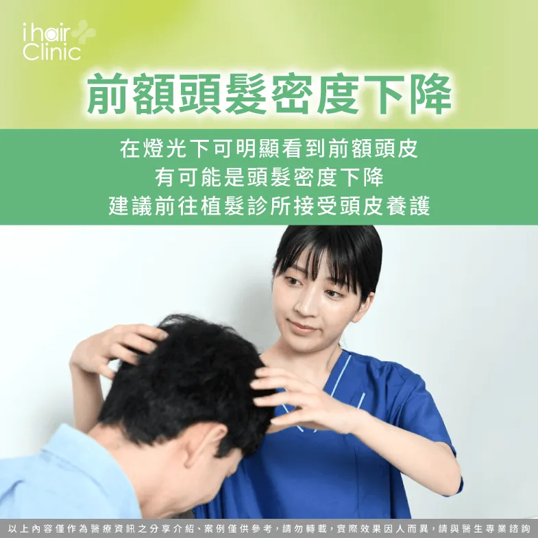 前額頭皮是否容易透光-髮線後移判斷