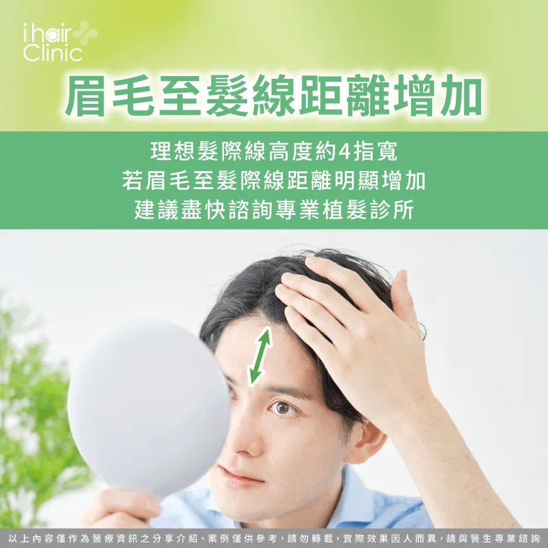 眉心至髮際線距離有無增加-髮際線後移 原因