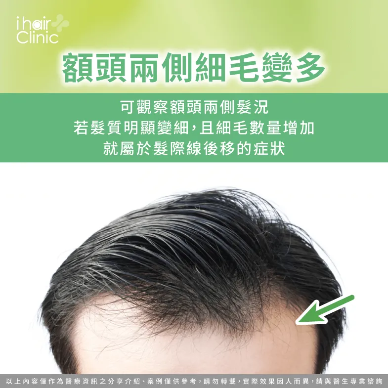 兩側額角細毛有無明顯增加-髮線後移判斷