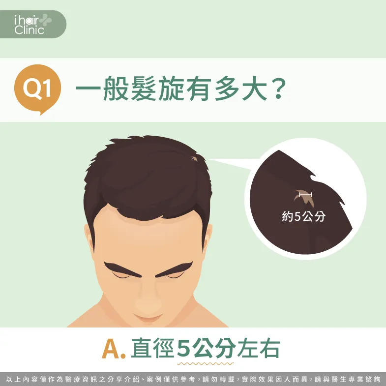 正常的髮旋大小落在5公分左右,呈現漸層的圓形 正常髮旋大小有多大-天生髮旋大怎麼辦