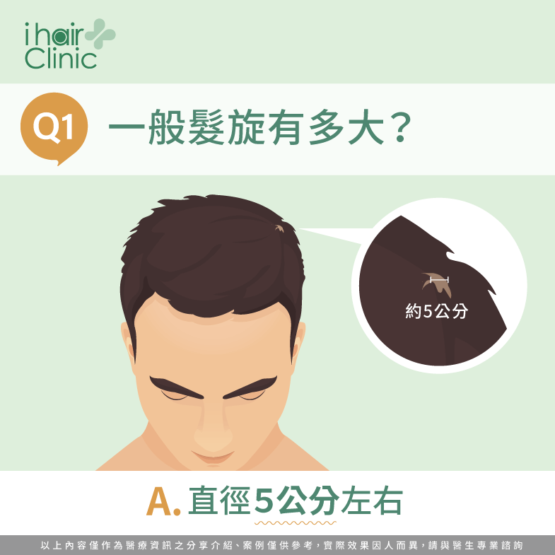 天生髮旋大怎麼辦?依照3種程度帶你改善-ihair風華御髮
