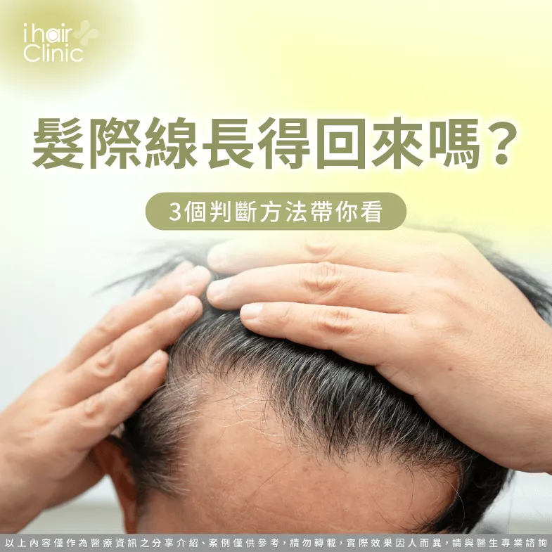 髮際線長得回來嗎?3個檢視方法一次為你解析 3個方法判斷髮際線是否健康-髮際線長得回來嗎