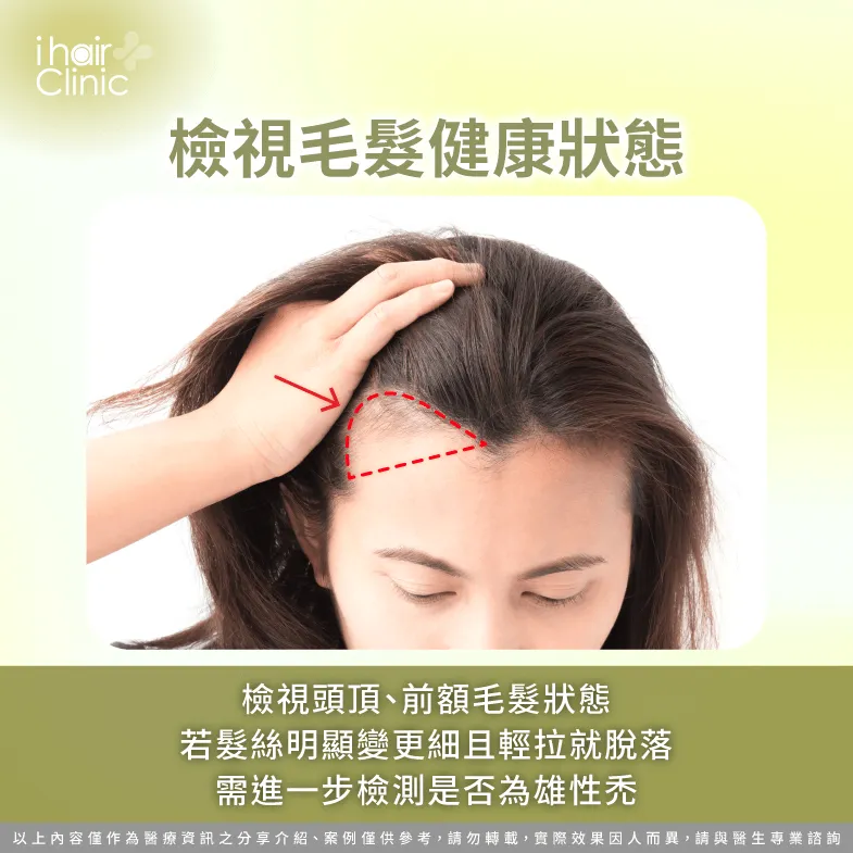 可觀察頭髮質地,確認頭髮是否明顯變細且易斷裂,如有相關症狀應前往植髮診所諮詢 檢視頭髮健康狀態是否有下滑-髮際線長回來
