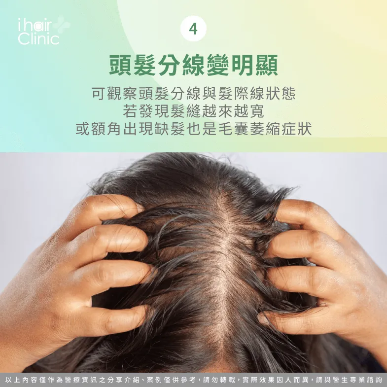 頭髮分線越來越寬或是髮際線後移-毛囊萎縮原因