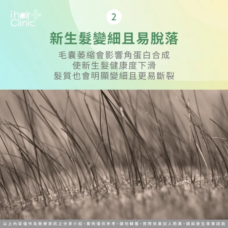 新生髮是否變細且易斷裂-毛囊萎縮原因