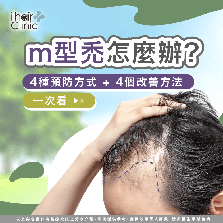 m型禿的預防及改善方法-m型禿怎麼辦