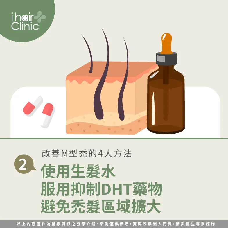 M型禿可以透過生髮水及藥物控制,抑制DHT對毛囊的影響! 透過生髮水及藥物控制掉髮-M型禿怎麼辦