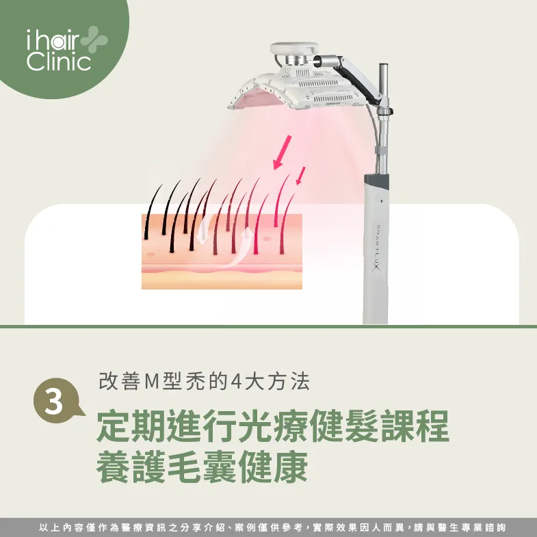 透過健髮課程照顧頭皮健康,避免M型禿問題越來越嚴重! 安排健髮課程養護頭皮健康-M型禿 改善